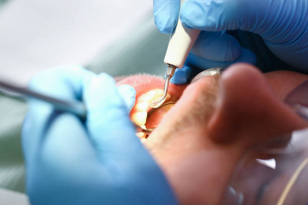 Best Pediatric Emergency Dentist in Madera Ranchos, CA