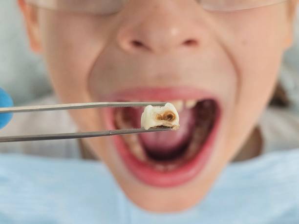 Best Weekend Emergency Dentist in Madera Ranchos, CA